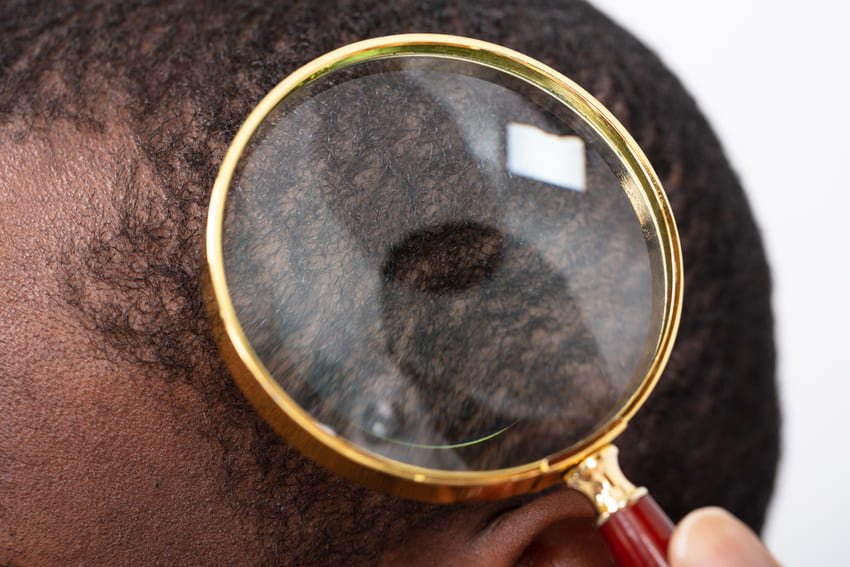 Bilan capillaire pour cheveux afro