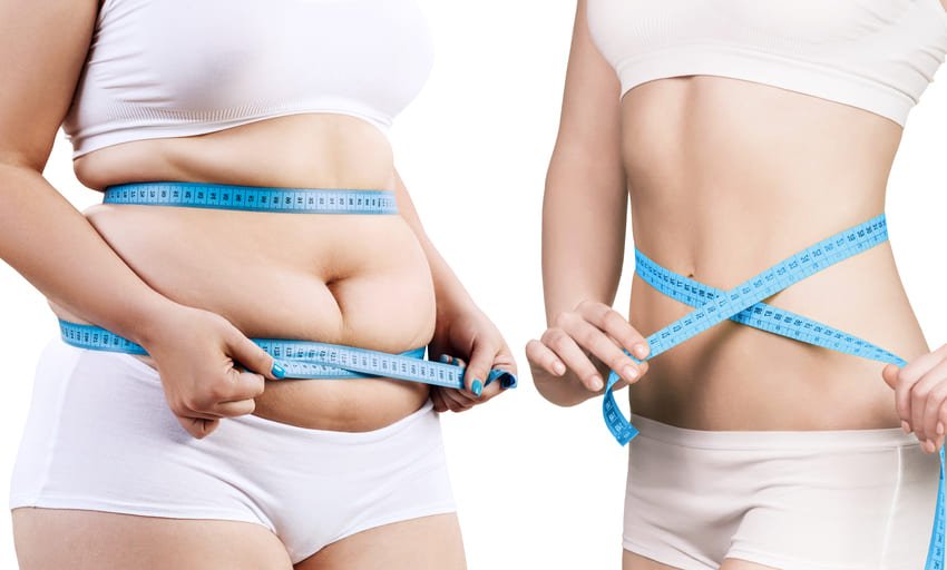 Simulation photo avant et après d'une liposuccion